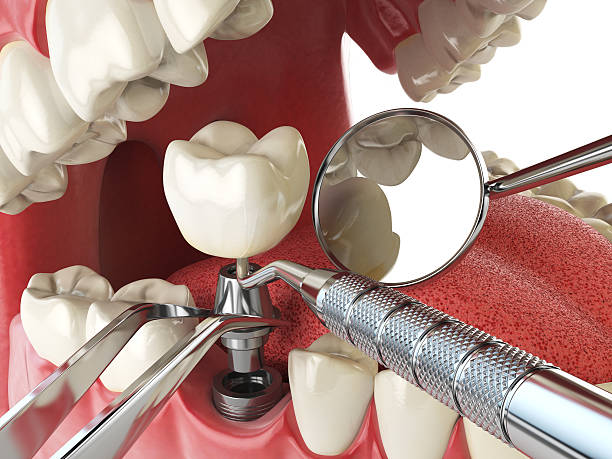 Best Holiday Emergency Dentist in Burbank, IL